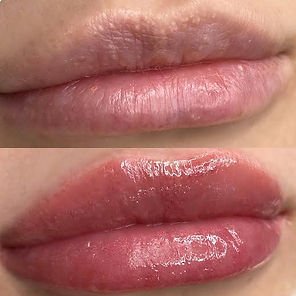 Lippenpigmentierung Stuttgart – Symmetrische Konturen