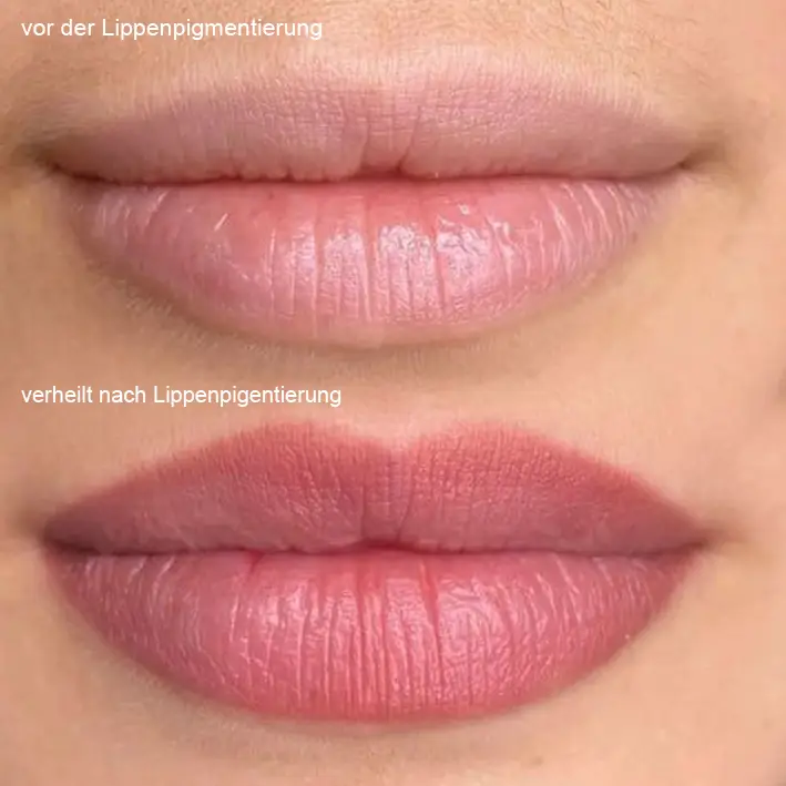 Volle-Lippen-Stuttgart