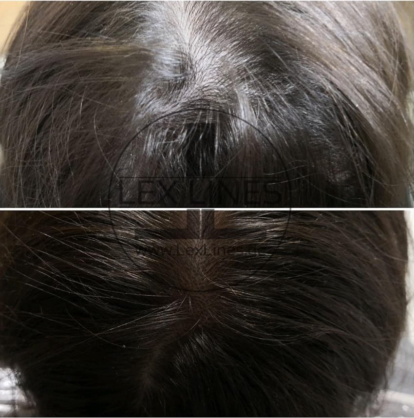 Haarpigmentierung Stuttgart