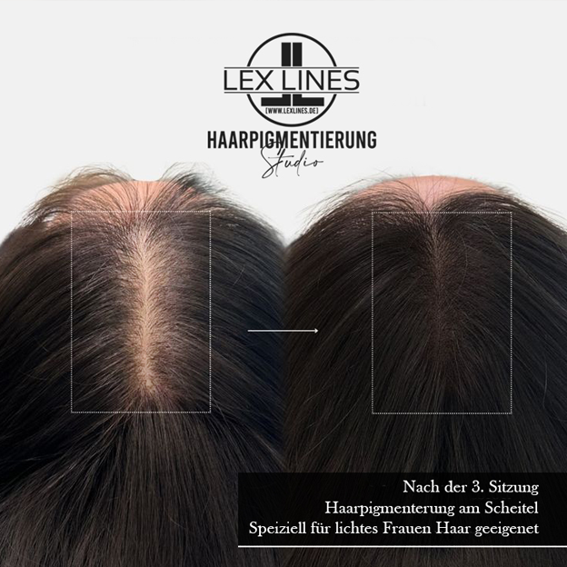 Haarpigmentierung2