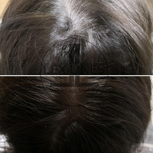 Haarpigmentierung_Stuttgart