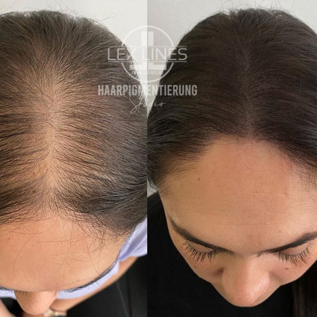 Haarpigmentierung_Stuttgart1