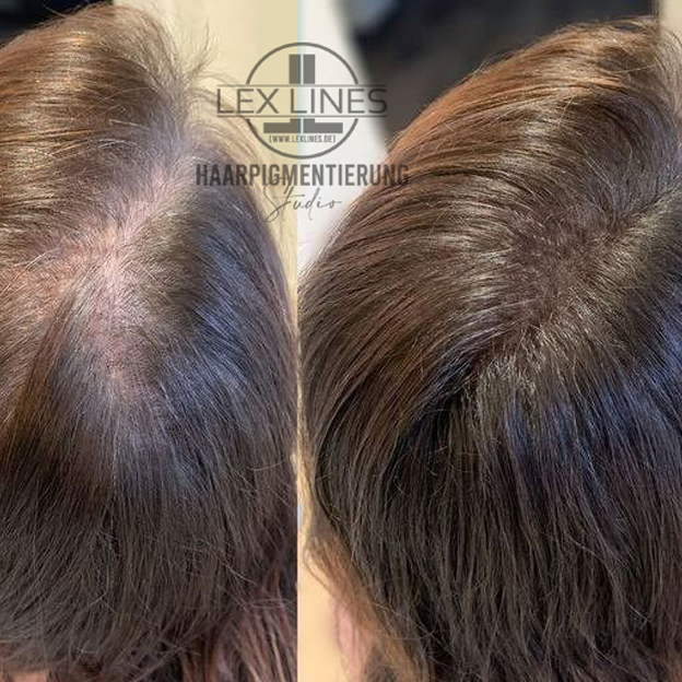 Haarpigmentierung_Stuttgart_Frauen